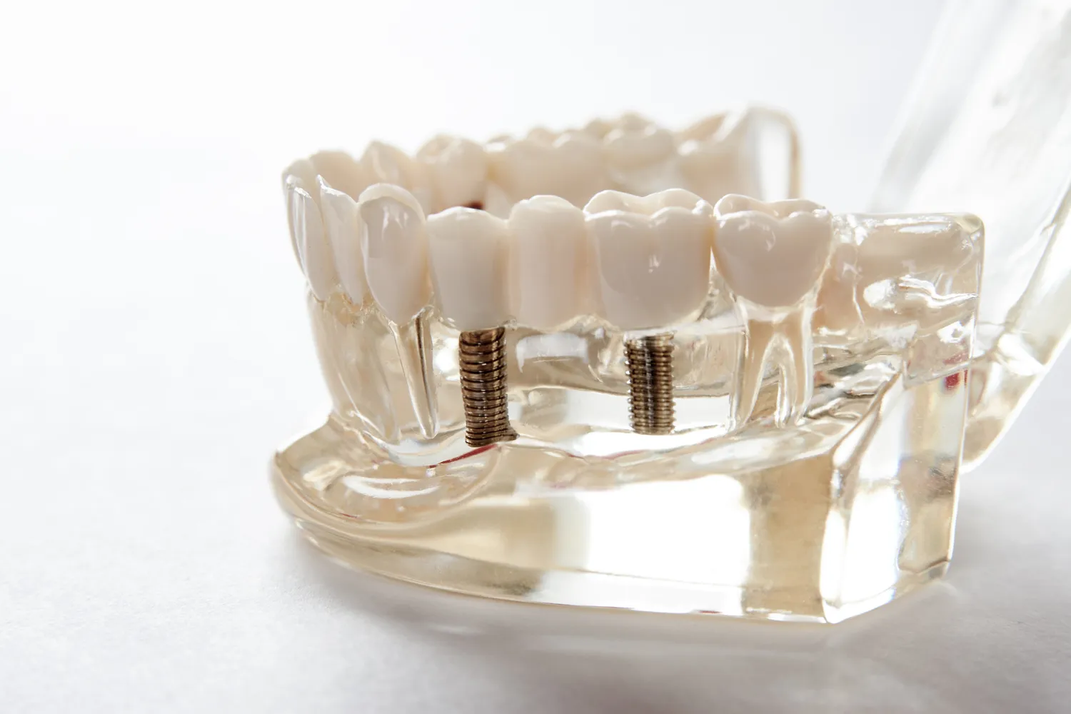 Dzieci u dentysty